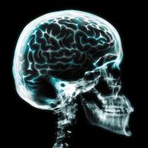 Gehirn: Die Heilmittelforschung bei Alzheimer läuft auf Hochtouren. Getty Images