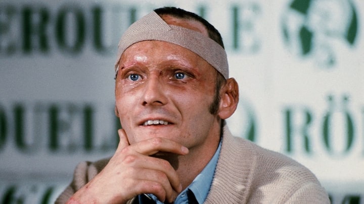 Niki Lauda am 08. September 1976 im Rahmen einer Pressekonferenz in Salzburg. Lauda, der sich die schweren Verletzungen bei einem Unfall auf dem Nürburgring am 1. August 1976 zugezogen hatte, kündigte an, dass er nach seiner Genesung wieder Autorennen fahren werde. Der dreifache Formel 1-Weltmeister und Airline-Chef feiert am 22. Februar 2019 seinen 70. Geburtstag. (ARCHIVBILD VOM 8.9.1976) - FOTO: APA/UPI/FRM