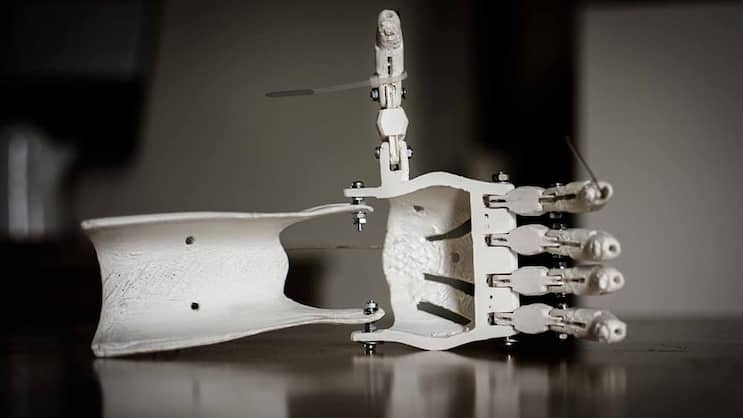 3D-Druck: Wird nach einem Scan aus dem Computertomographen entworfen.Pixabay