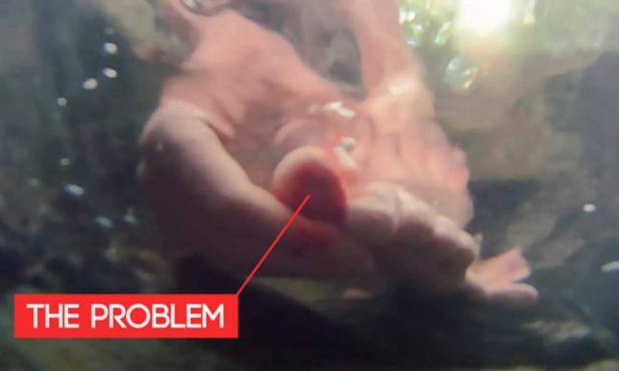 Viele Sportarten machen ohne Schuhe mehr Spass und sind gesünder. Doch man kann sich dabei leicht verletzen...