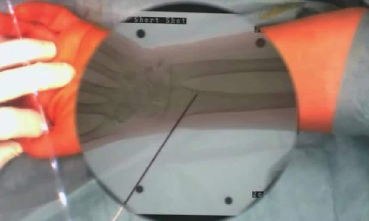 Ärzte profitieren stark von sogenannter «Augmented Reality». In der Medizin gibt es beinahe unbegrenzte Anwendungsmöglichkeiten für die Technologie.
Youtube/ieeeComputerSociety