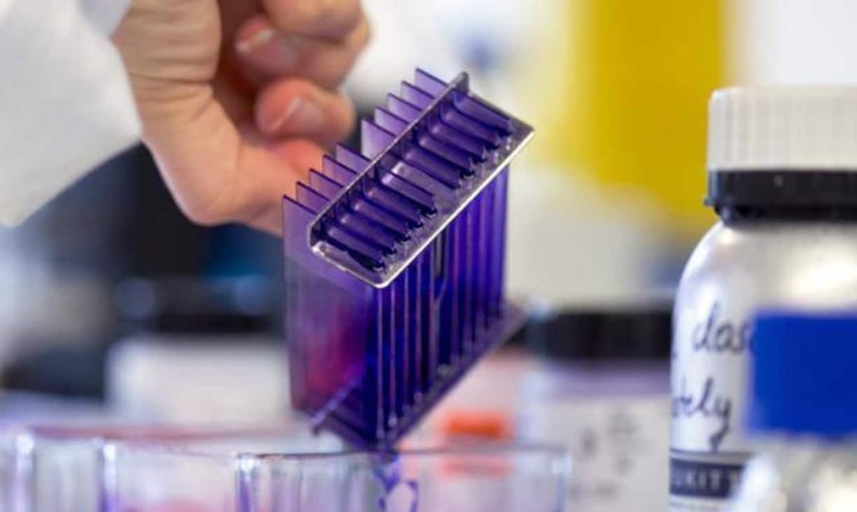 Der Pharmakonzern Elanco baut im Teil «Tiermedizin» 48 der 260 Stellen ab.