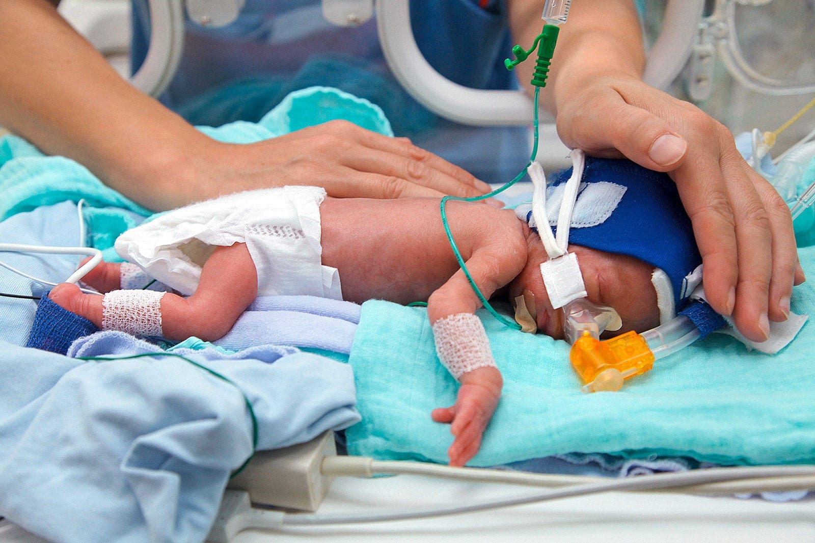 Frühchen werden intensivmedizinisch betreut, und zwar rund um die Uhr.