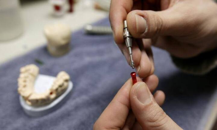 Straumann: Die weltweite Nummer eins bei Zahnimplantaten und für orale Geweberegeneration wird ebenfalls zur Alpha-Aktie hochgestuft.